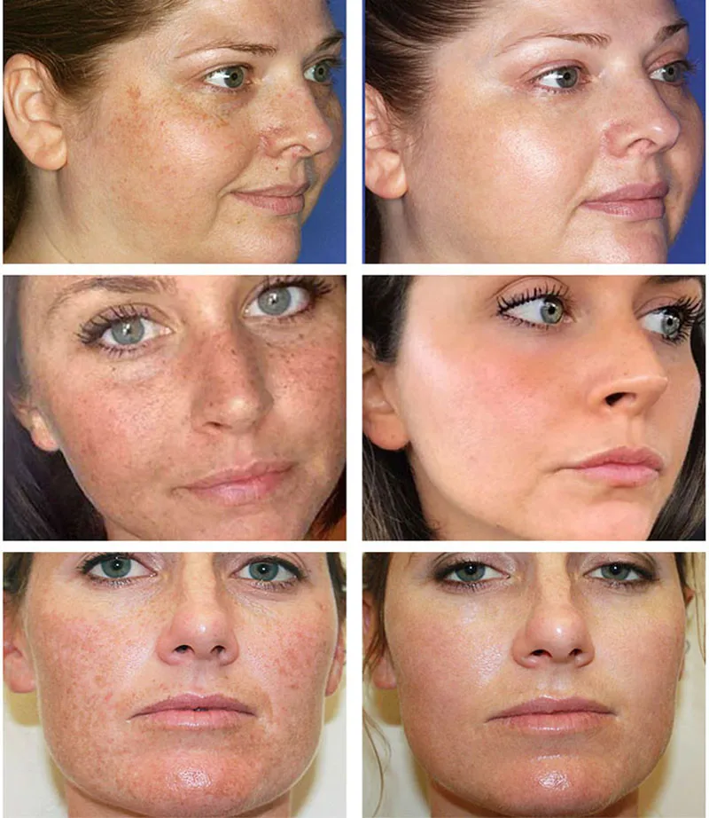 كريم تبييض قوي لإزالة البقع يف - مراجعة Luxury Skincare Brands وسعره