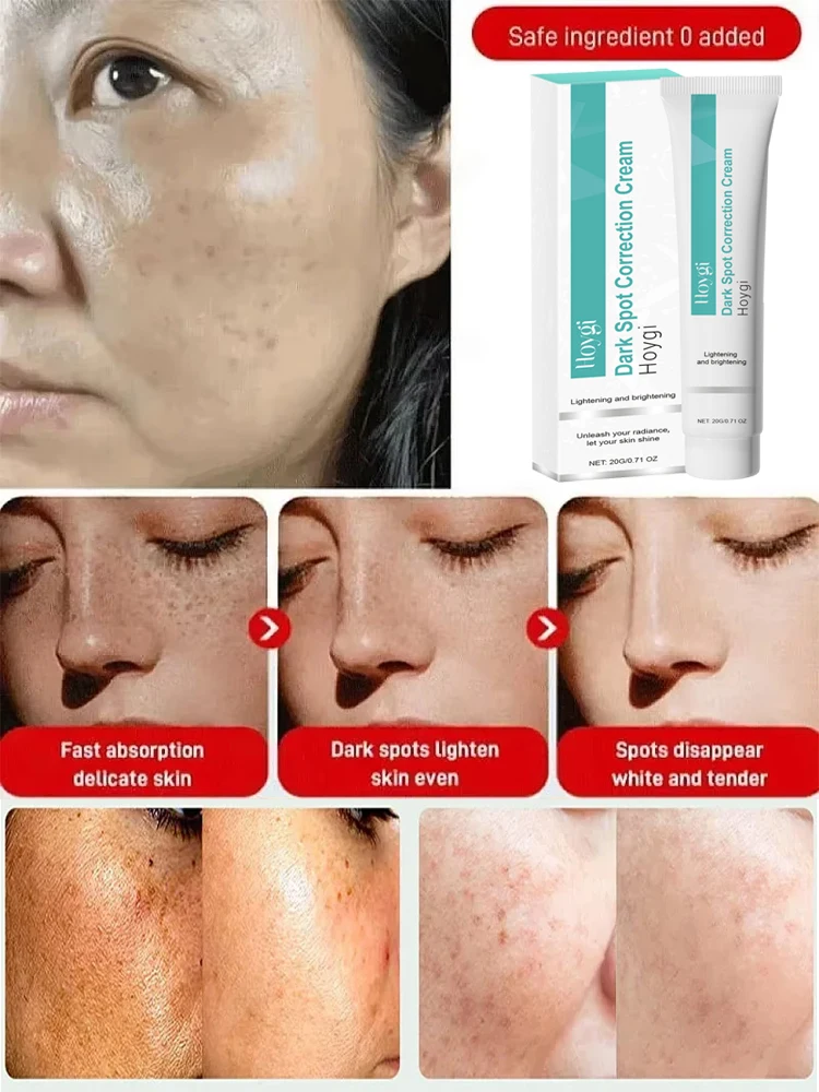 كريم تبييض قوي لإزالة البقع يف - مراجعة Luxury Skincare Brands وسعره