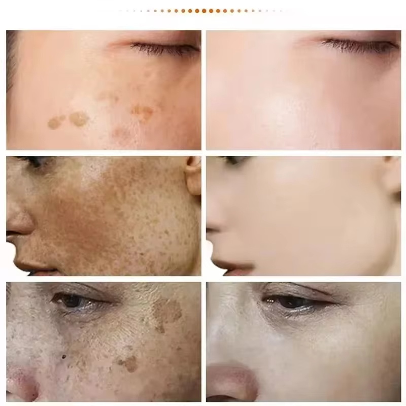 كريم تبييض قوي لإزالة البقع يف - مراجعة Luxury Skincare Brands وسعره