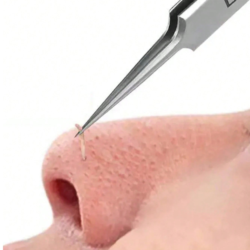 4/6 قطعة مجموعة تنظيف الوجه بث - مراجعة Luxury Skincare Acne وسعره