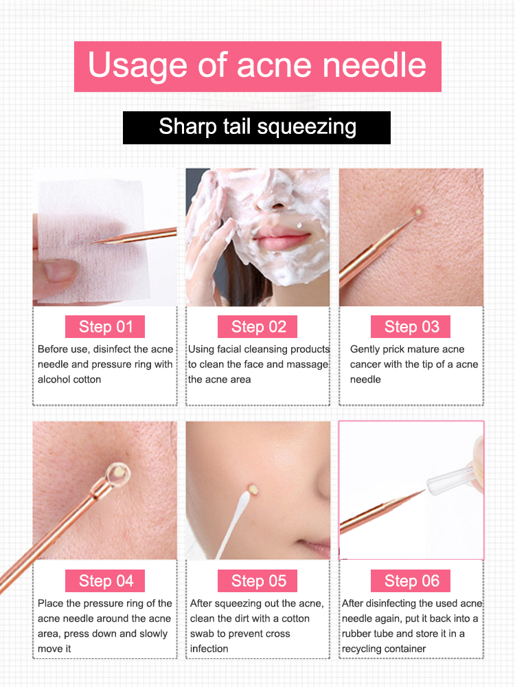 أداة إزالة الرؤوس السوداء بثرة - مراجعة Luxury Skincare Acne وسعره