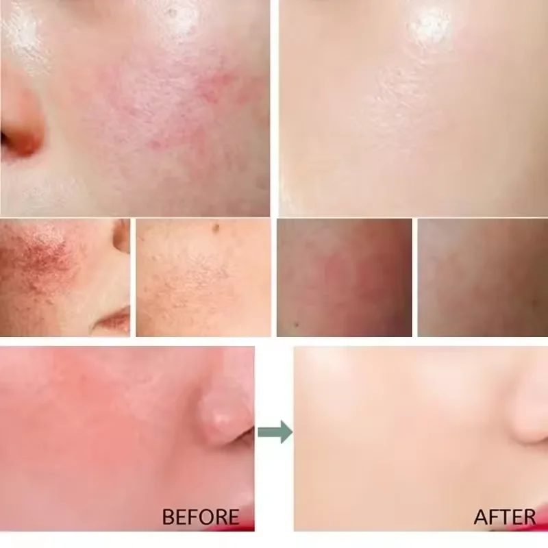 كريم إصلاح احمرار الوجه تحسين  - مراجعة Luxury Skincare Brands وسعره