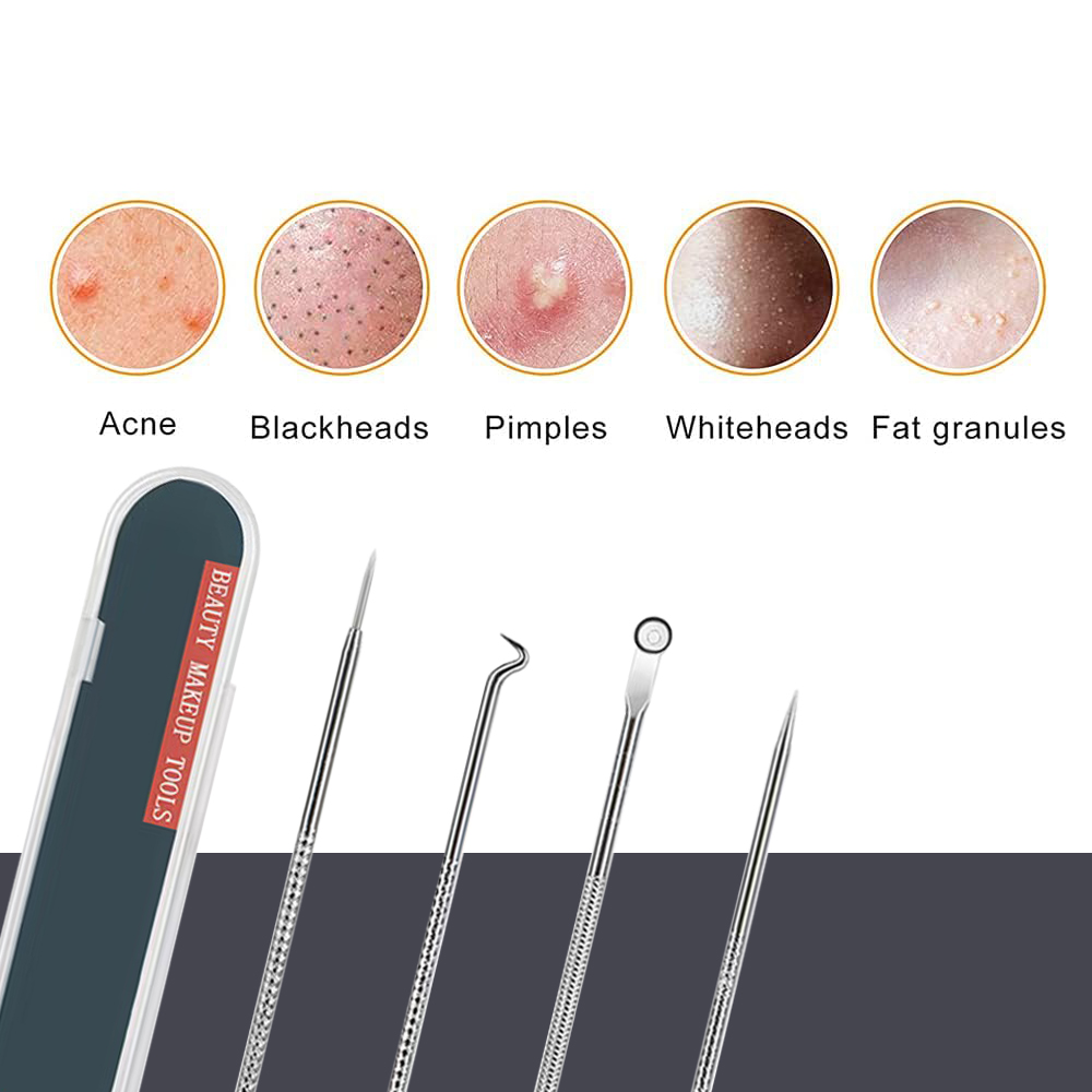 مجموعة أدوات إزالة البثور ورؤو - مراجعة Luxury Skincare Acne وسعره