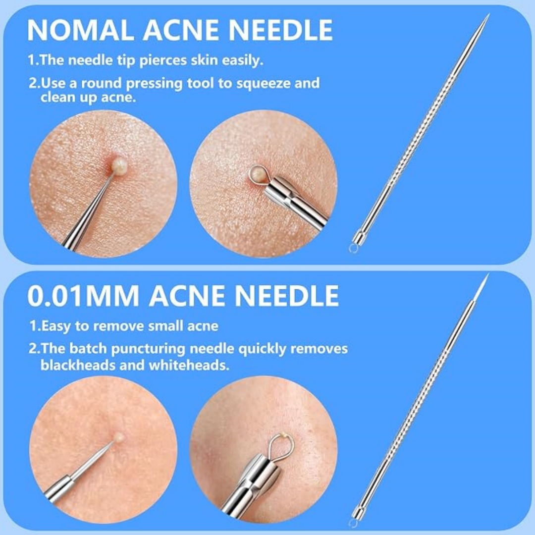 مجموعة أدوات إزالة الرؤوس السو - مراجعة Luxury Skincare Acne وسعره