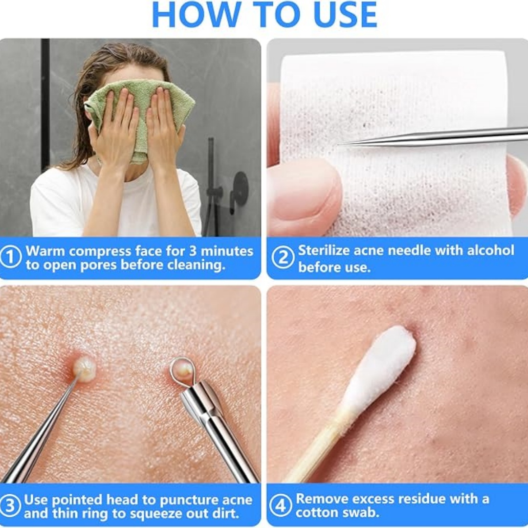 مجموعة أدوات إزالة الرؤوس السو - مراجعة Luxury Skincare Acne وسعره